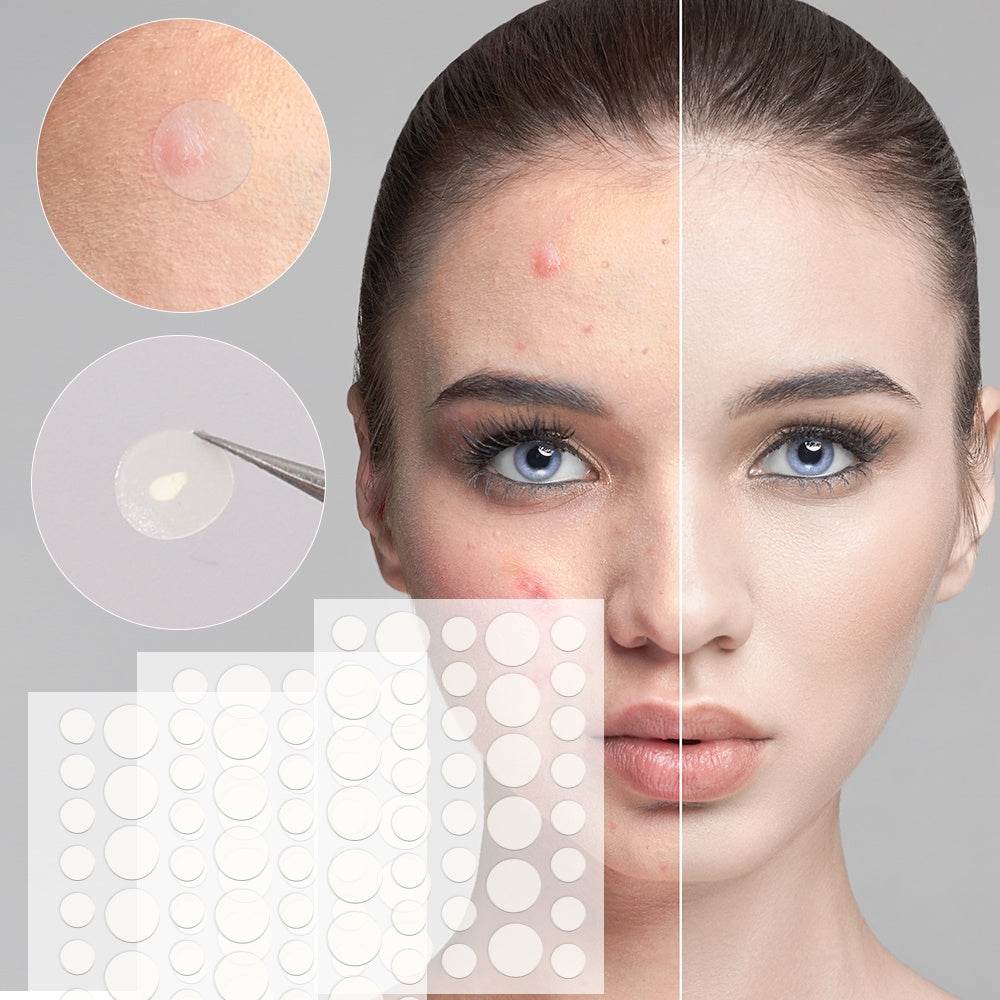 Combo Cero Acné: 72 Parches Invisibles + Crema Bioaqua con ácido salicílico