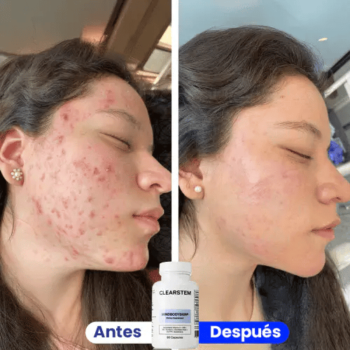 Encabezado