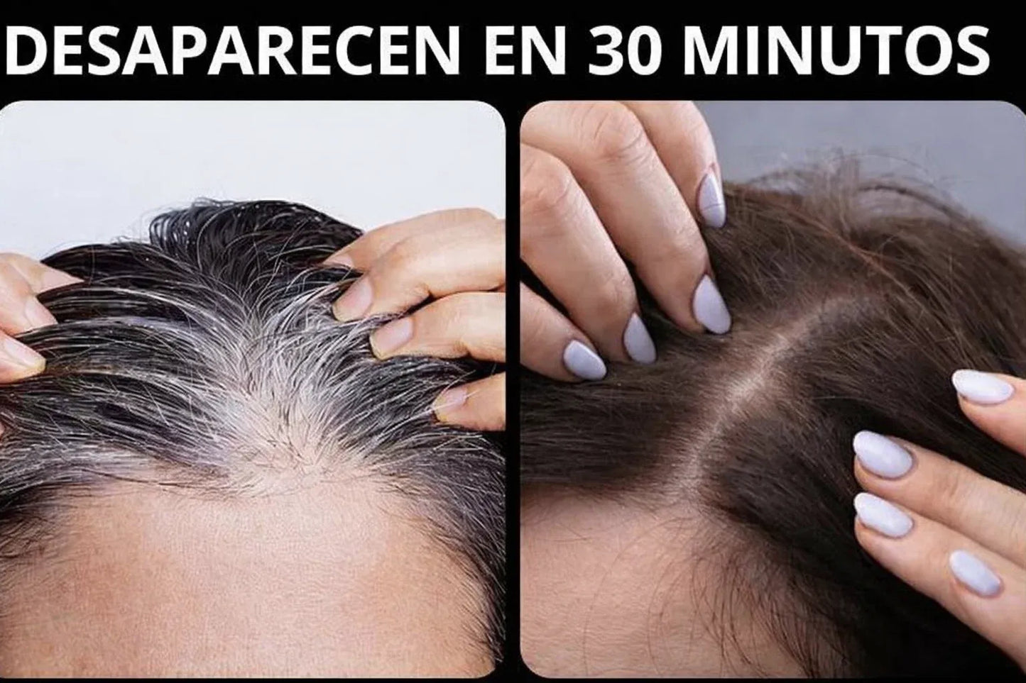 CHAO CANAS 5 EN 1, CON ROMERO Y AGUACATE, PAGA 1 Y LLEVA 3 PRODUCTOS; CHAMPÚ, TRATAMIENTO Y ACTIVADOR